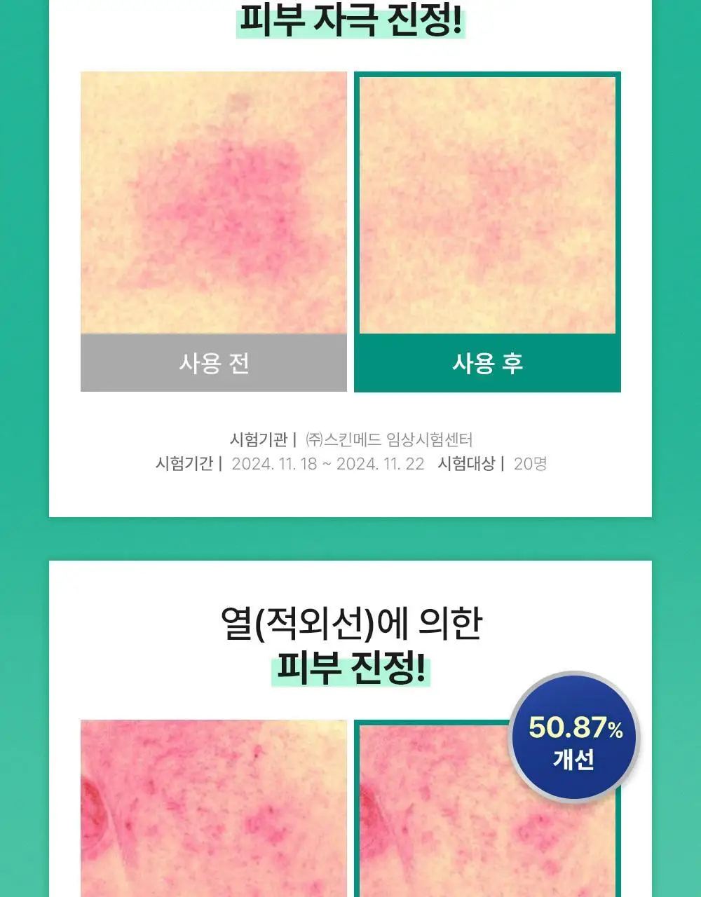 [민감피부진정/쿨링수분크림] 셀퓨전씨 포스트 알파 시카 카밍 다운 크림 50ml 기획 (+50ml 리필) 상세페이지 11